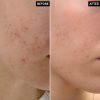 The Inkey List MANDELIC ACID TREATMENT 30ml for Dark Spot - Image 2